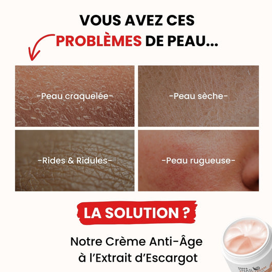 Crème Anti-Âge à l’Extrait d’Escargot