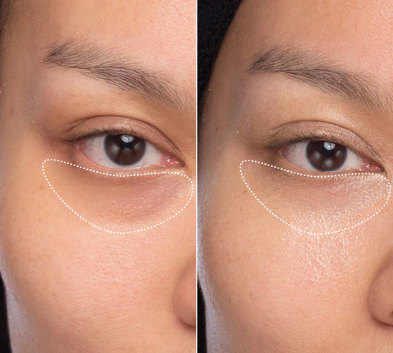 Le regard transformé