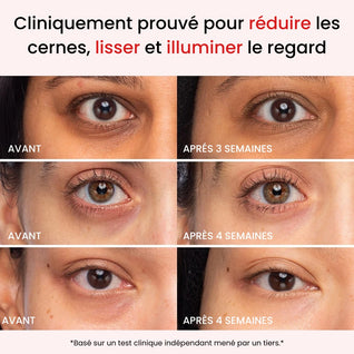 Coffret Régénération Intense