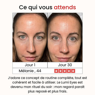 Coffret Régénération Intense