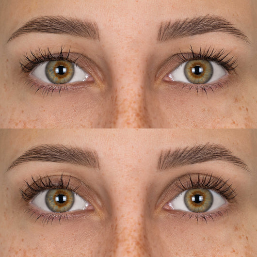 Patchs Lift Paupières